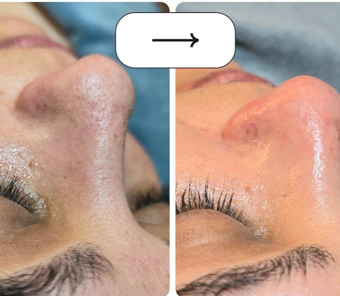 Facial Detox foto 1